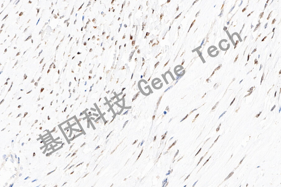 p21&GT2043-平滑肌瘤-20X-细胞核 _副本.jpg