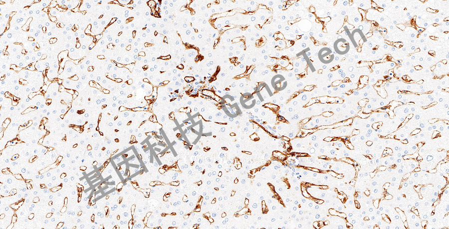 CD31&GT2321-肝脏x20_副本.jpg