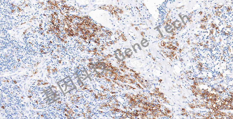 CD38&GT2129-扁桃体-20X-1_副本.jpg