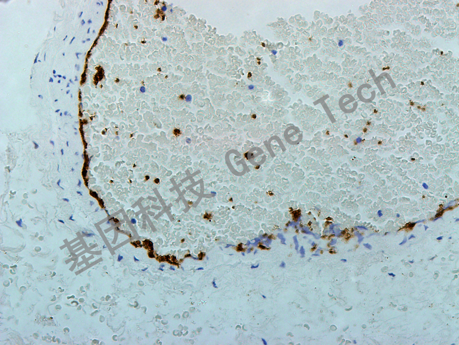 CD42b GT2238 40X 扁桃体染血小板_副本.jpg