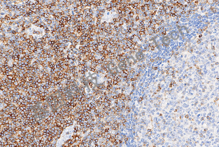 CD43&GM0786-淋巴结-20X-细胞膜+细胞浆_副本.jpg