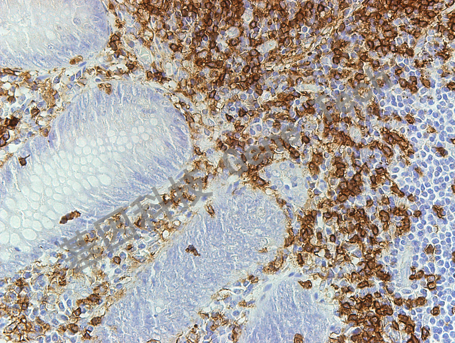 CD45RO GM0742 40X 阑尾_副本.jpg