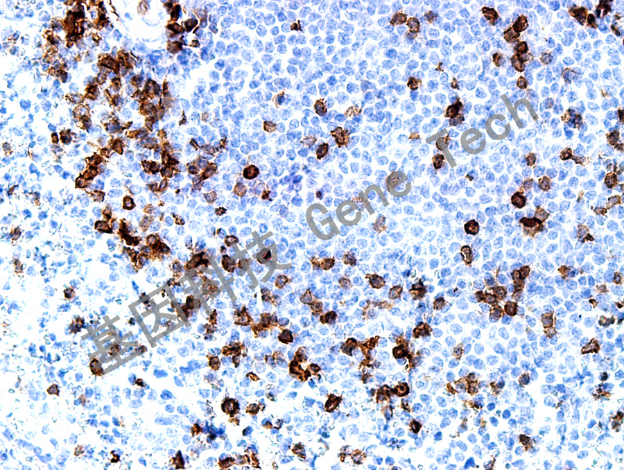 CD5&GM3633- 脾-40X_副本.jpg