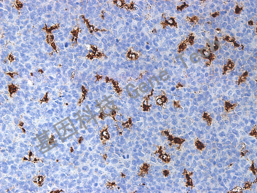CD68 GM0814 tonsil_副本.jpg