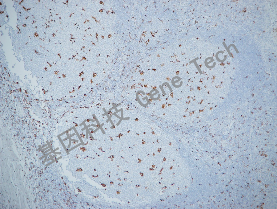 CD68&GM0876-扁桃體-10x_副本.jpg