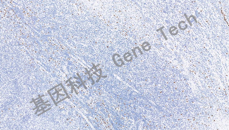 MNDA-扁桃體_副本.jpg