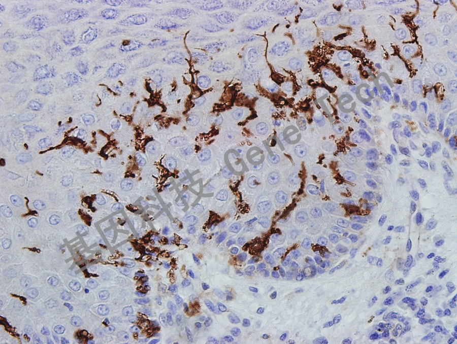 CD1a GM3571 皮肤_副本.jpg