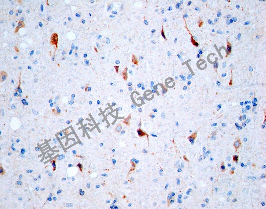 Amyloid-β&GT2299-阿尔兹海莫脑组织_副本.jpg