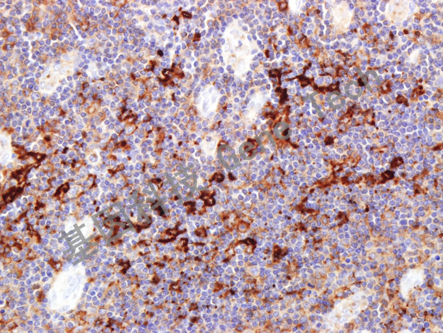 CD205 GT2276 扁桃体 40X_副本.jpg