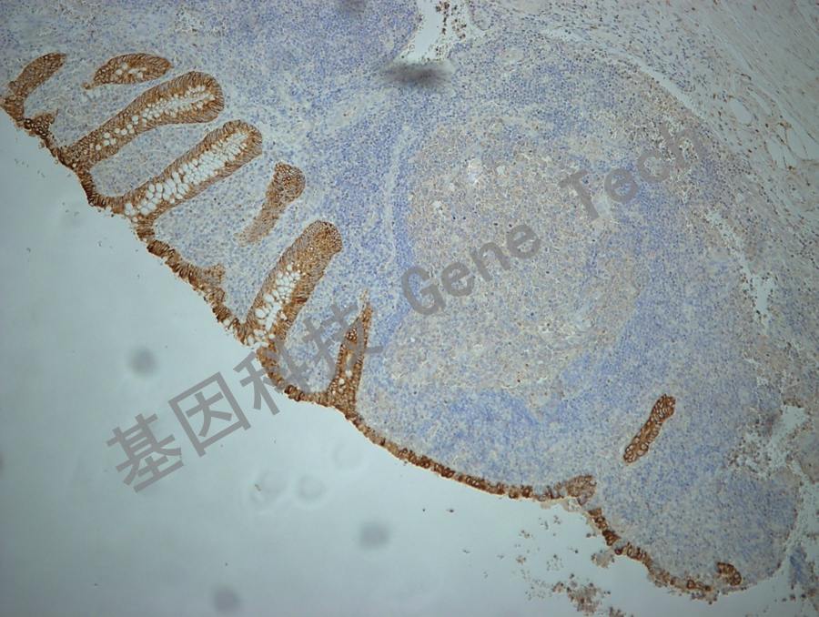 CKL GT2246 10X 阑尾_副本.jpg