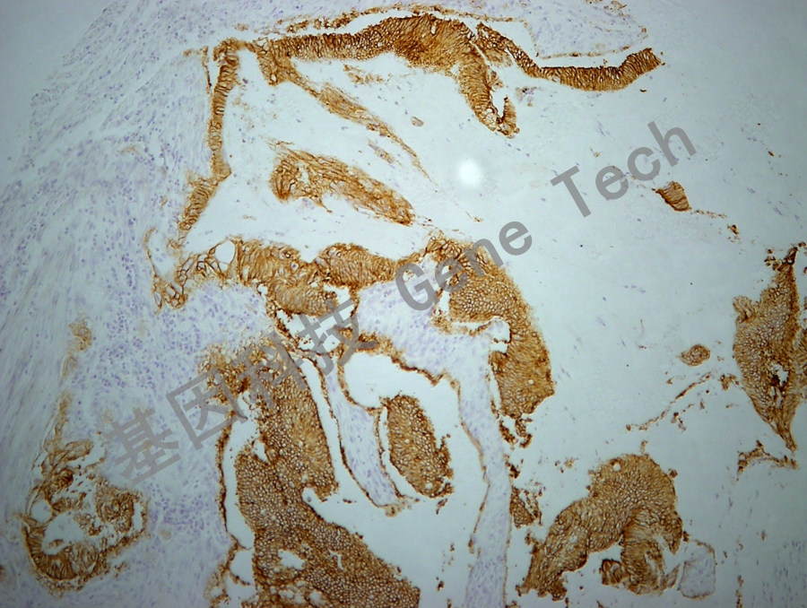 1772759149541681.jpg ERA(MOC31) GM3525 结肠癌 10X_副本.jpg