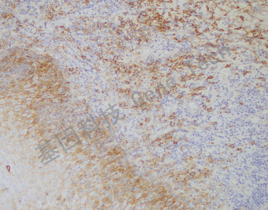 20210413-1 CD138 W62 扁桃体-1_副本.jpg